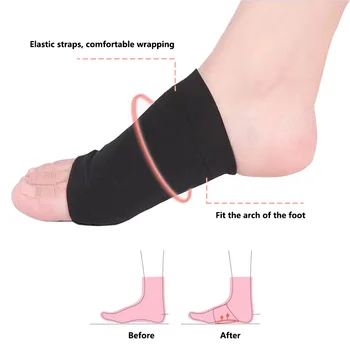 1 Pár Ploché Nohy Ortopedické Ponožky Arch Plantárna Fasciitis Unisex Oprava Nohy Podložky Masážne Zmiernenie Bolesti, Starostlivosť O Nohy Nástroj Obrázok 2
